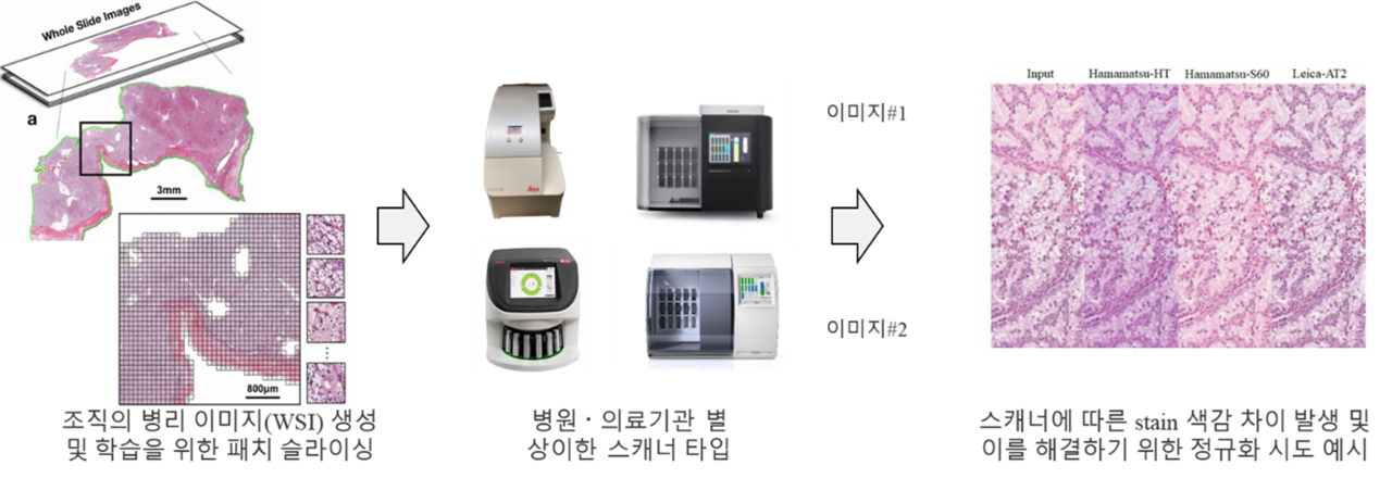 그림 4. 스캐너에 따른 병리 슬라이드 이미지의 색상 변화 문제. 우측은 스캐너의 차이 보정을 위한 정규화 과정 예시 (출처: https://doi.org/10.48550/arXiv.2204.09782)