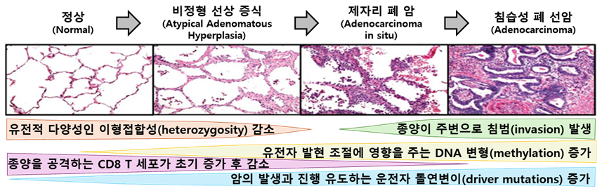 그림 5. 폐암 선암 기준의 모호한 스펙트럼성 상태(레이블) 예시 (출처: https://doi.org/10.1371/journal.pone.0021443)